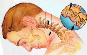 Cervical department