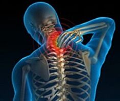 osteochondrosis of the cervical vertebrae