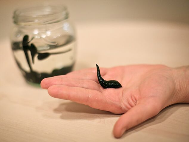 application for the treatment of osteoarthritis of the knee joint