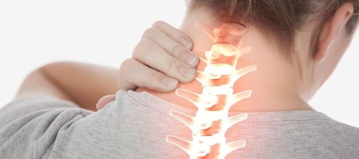 Osteochondrosis of the cervical vertebrae, accompanied by neck pain